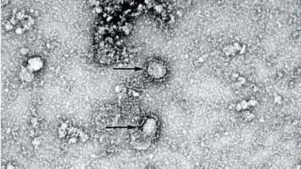 Novo coronavírus chega à Europa com confirmação de 2 casos na França; Nepal também entra na lista