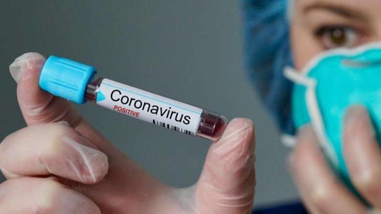 Matupá tem dois casos suspeitos do Novo Coronavírus (Covid-19)