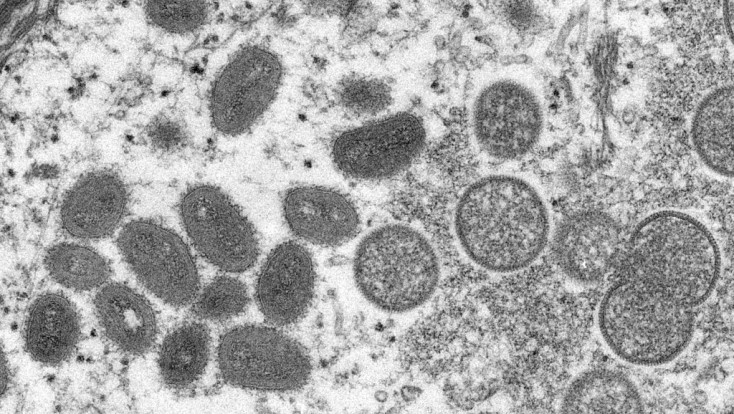 EUA detectam pela primeira vez dois casos de varíola dos macacos em crianças