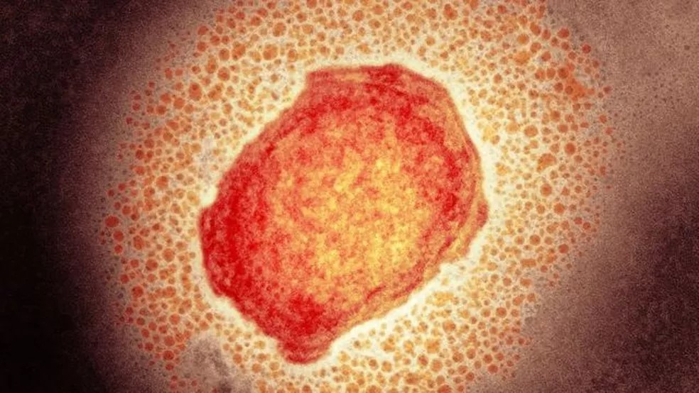 Mato Grosso confirma dois casos de varíola dos macacos