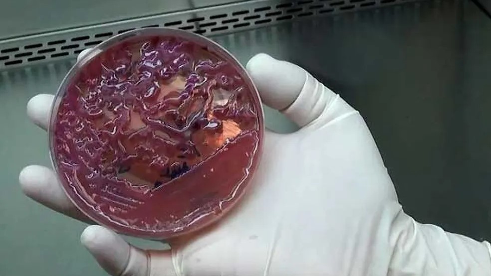 Resistente a antibióticos e 'praga' em hospitais: saiba mais sobre a superbactéria que matou 5 bebês